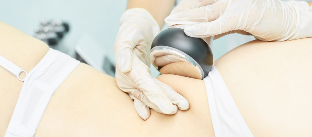 ultrasonic body cavitation melt fat Chicago