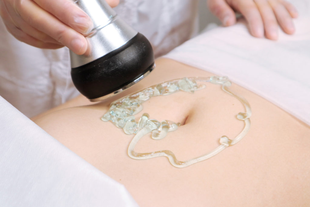 ultrasonic body cavitation Chicago body contouring