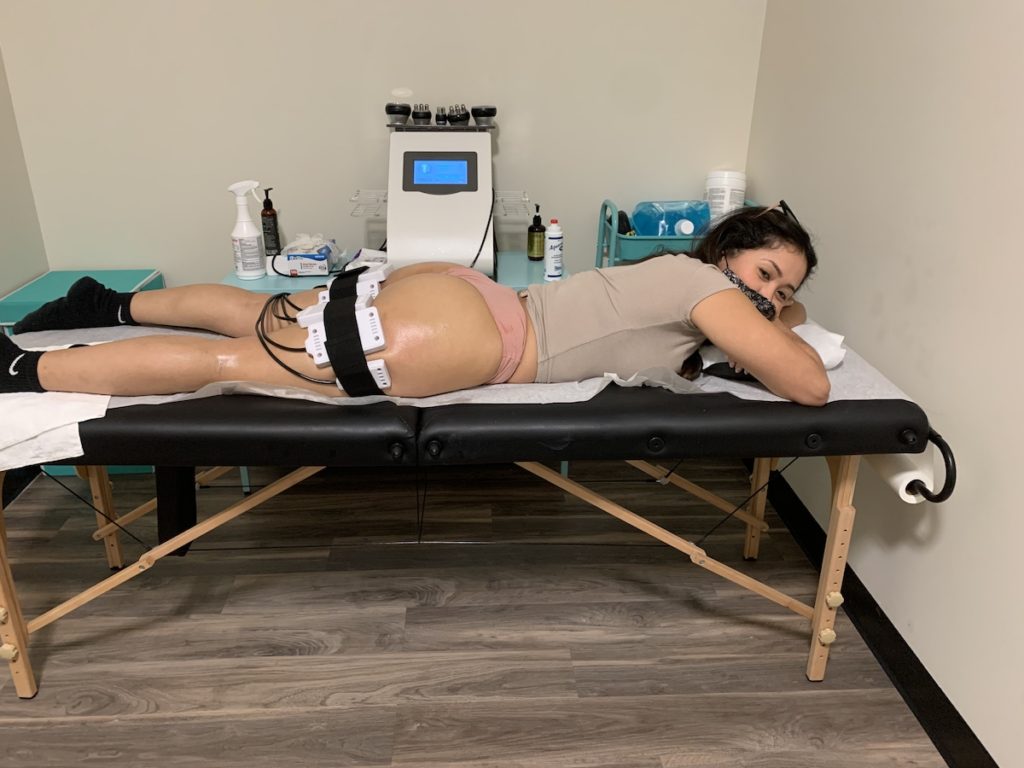 noninvasive laser lipo Chicago TushToners body sculpting