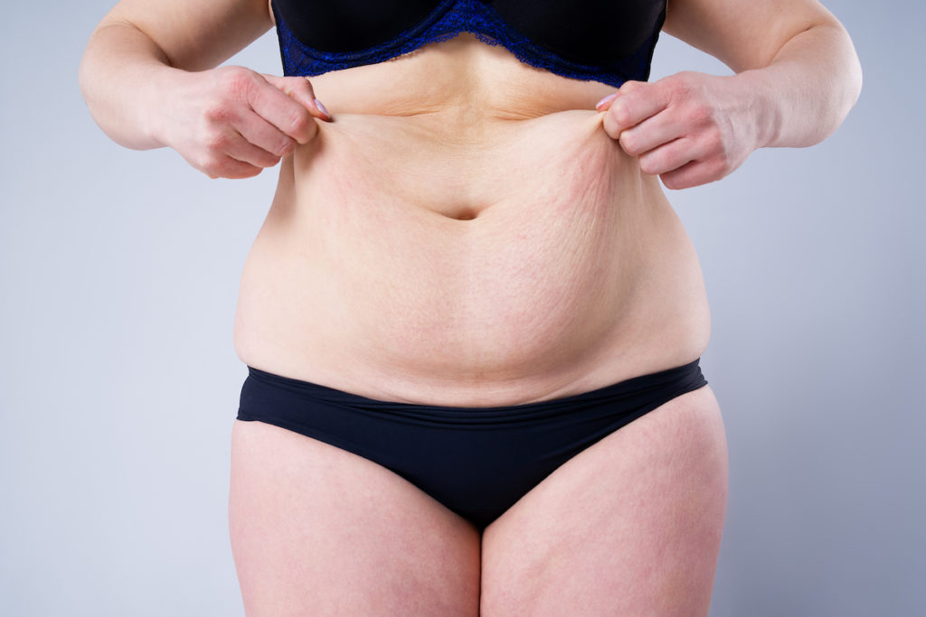 who should get body contouring Chicago