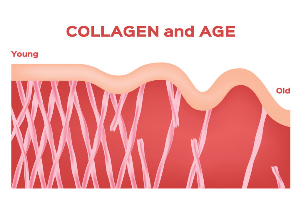 Collagen and cellulite weight loss Chicago