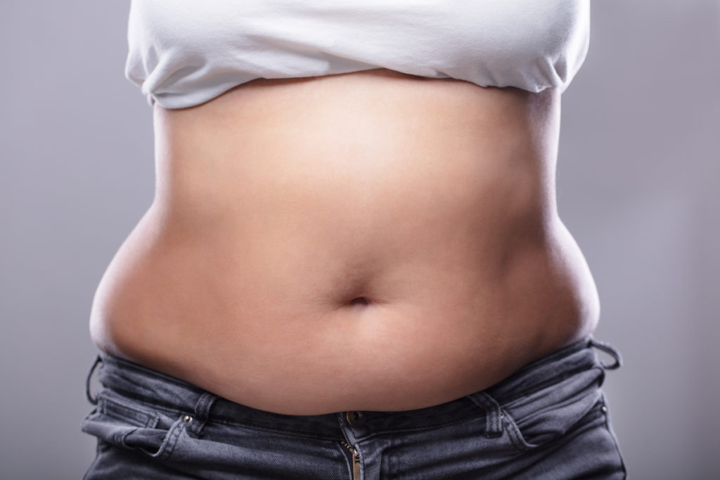 Excess Fat on Tummy, Hips and Thighs - The Tweakments Guide