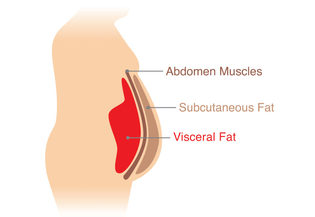visceral fat chicago noninvasive weight loss