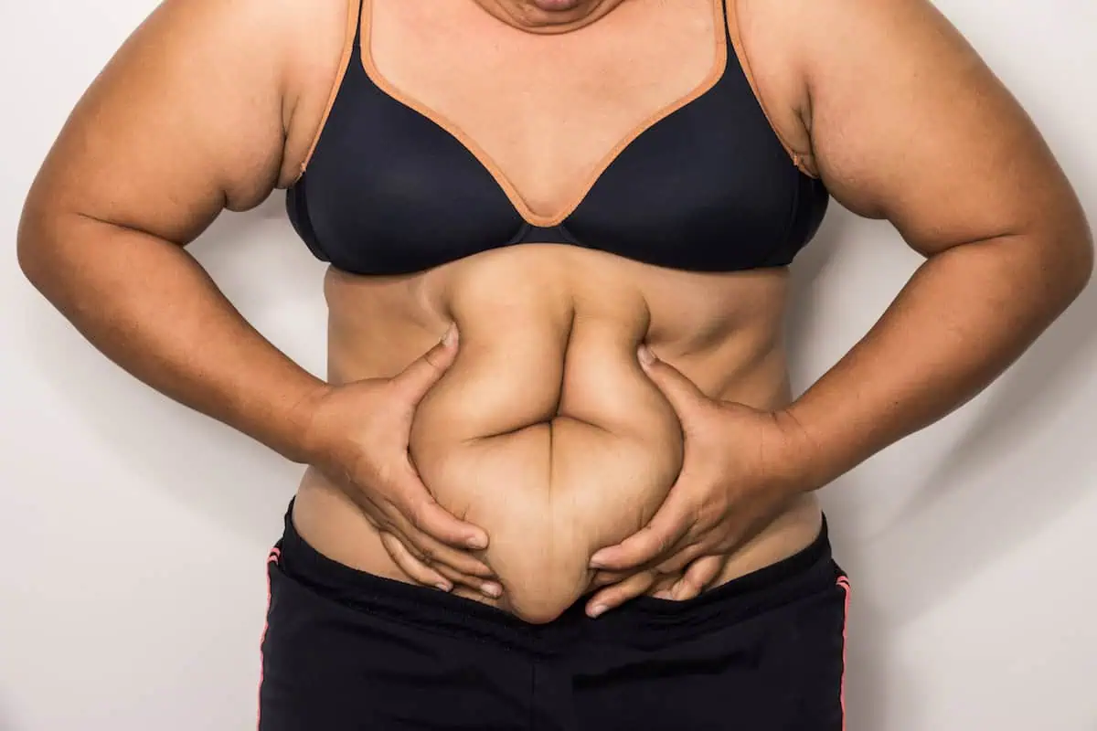 Body Contouring for Stomach Fat: 3 Simple Session Plans by Waistline