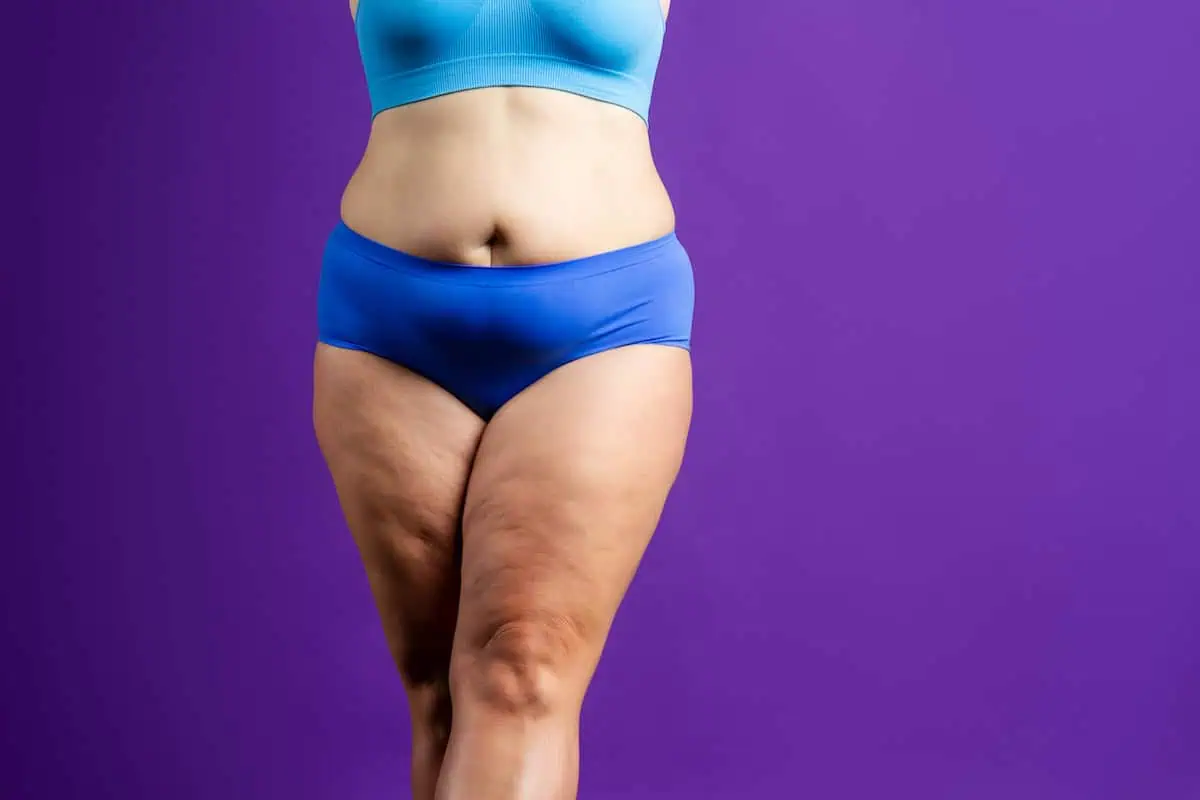 Benefits of Body Contouring: 4 Groups Who Gain the Most, a Simple Guide