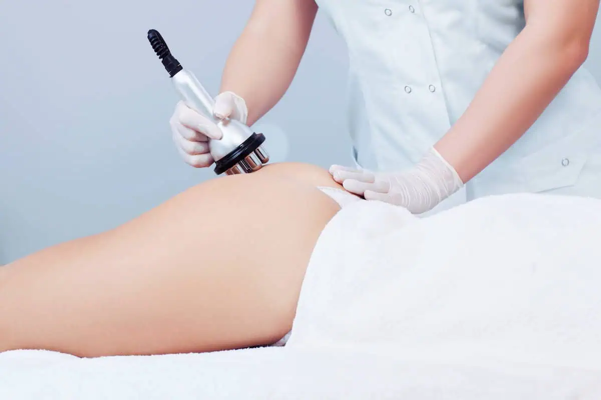 What’s the Difference Between Radiofrequency and Laser Lipo?