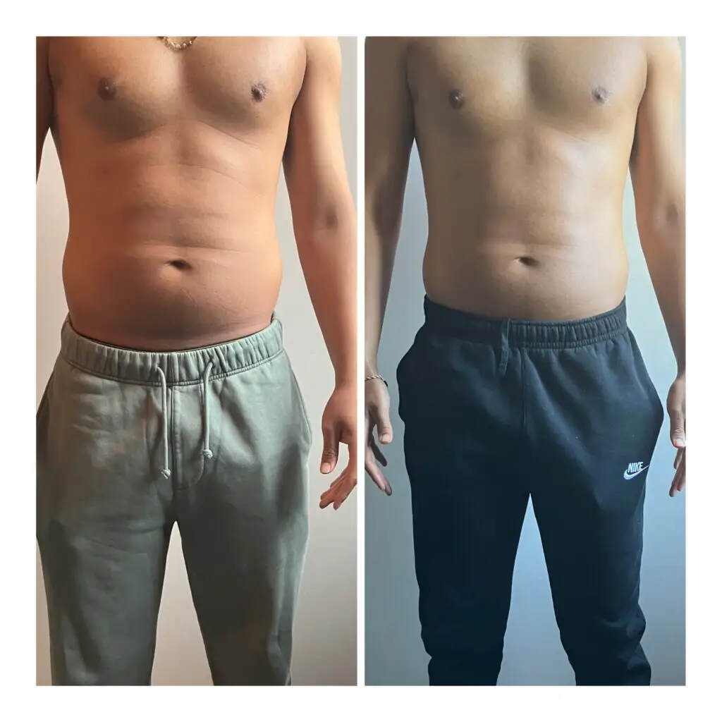 man body contouring ultrasonic cavitation radiofrequency