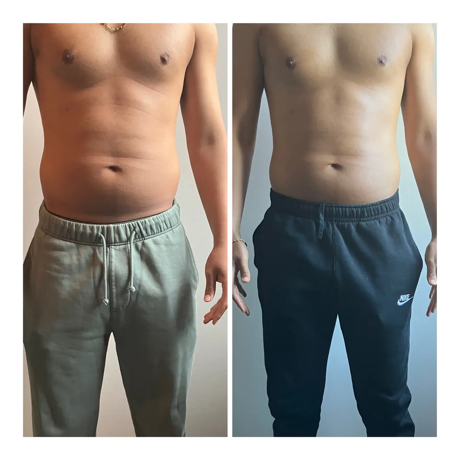 man body contouring ultrasonic cavitation radiofrequency