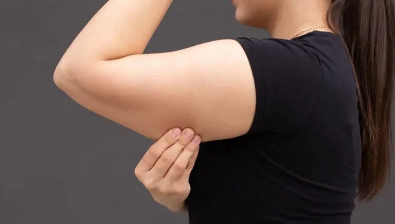 Radiofrequency for Your Arms: Can It Tighten Loose Arm Skin?