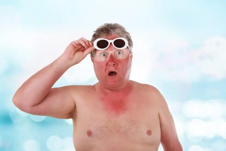 Radiofrequency Side Effects: Sunburn Risk and 4 Simple Precautions
