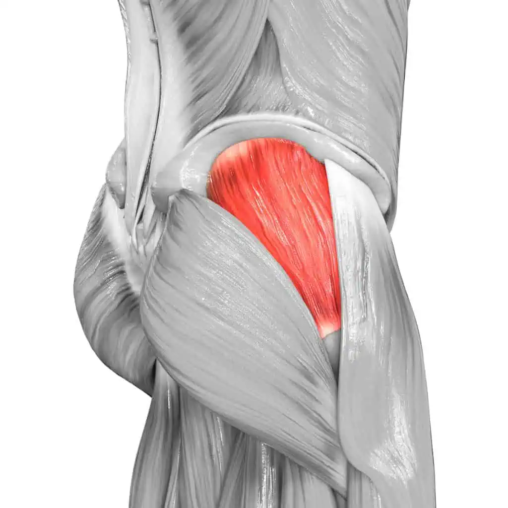 Gluteus Medius cellulite treatment Chicago