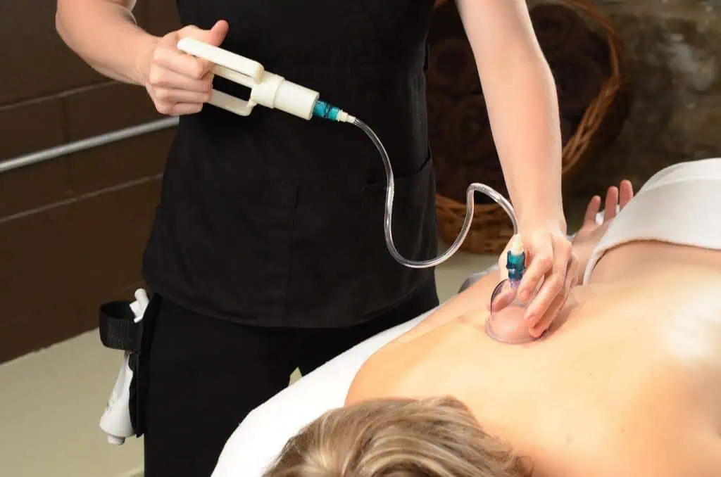 Cupping therapy Chicago TushToners non-invasive