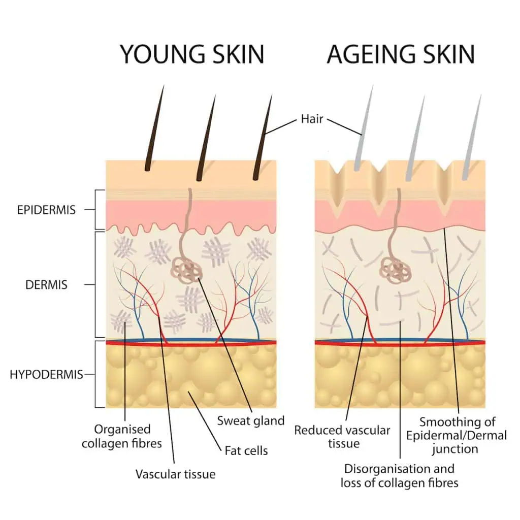 does cellulite get worse with age at TushToners