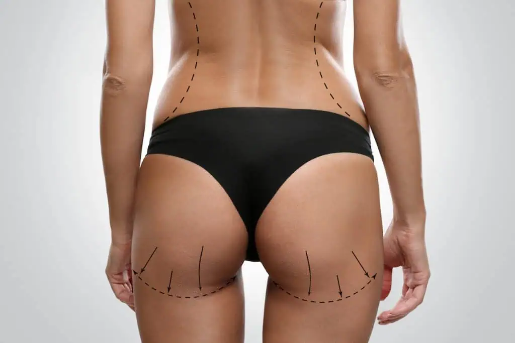 body contouring cost: non-invasive session at TushToners