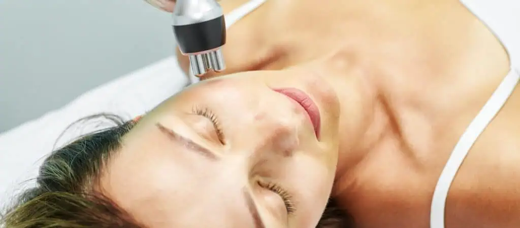 radiofrequency side effects: sun sensitivity after treatment