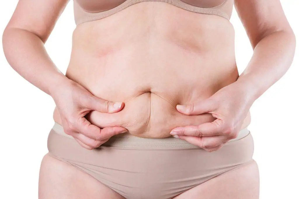 saggy skin Chicag skin tightening TushToners