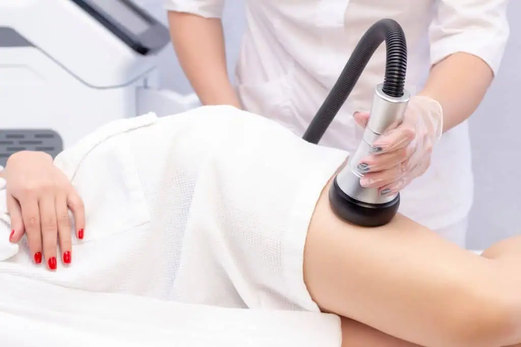 Chicago summer weight loss body contouring