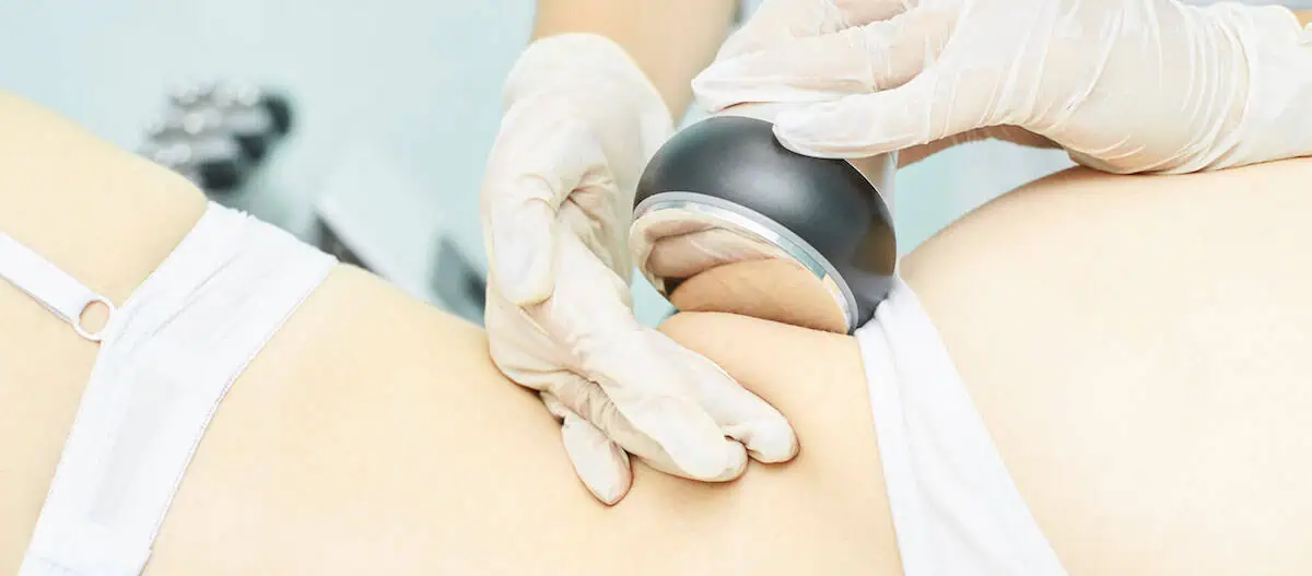 ultrasonic body cavitation melt fat Chicago