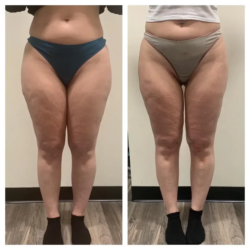 Before treatment: 31 years