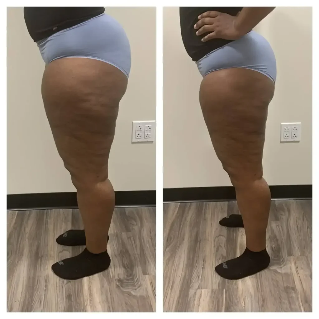 Before treatment: 31 years