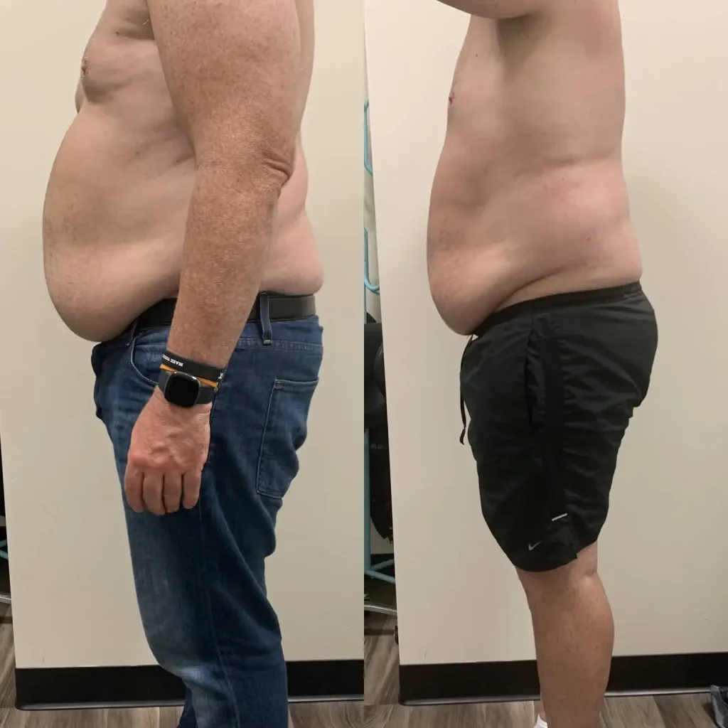 Before treatment: 31 years