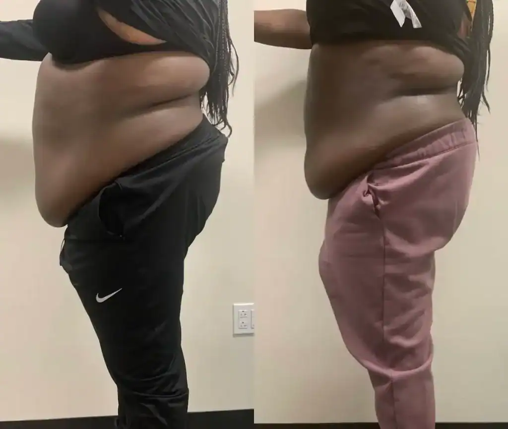 Before: 32 years · three 90-min sessions