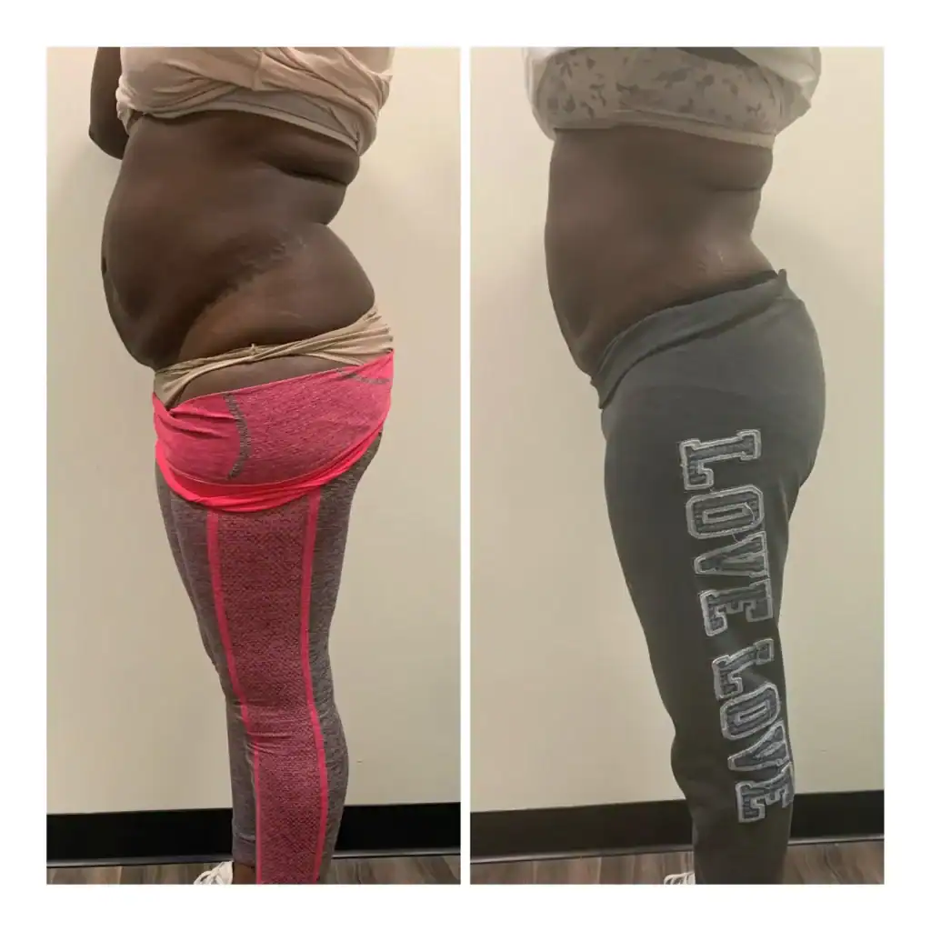 Before: 37 years · three 90-min sessions
