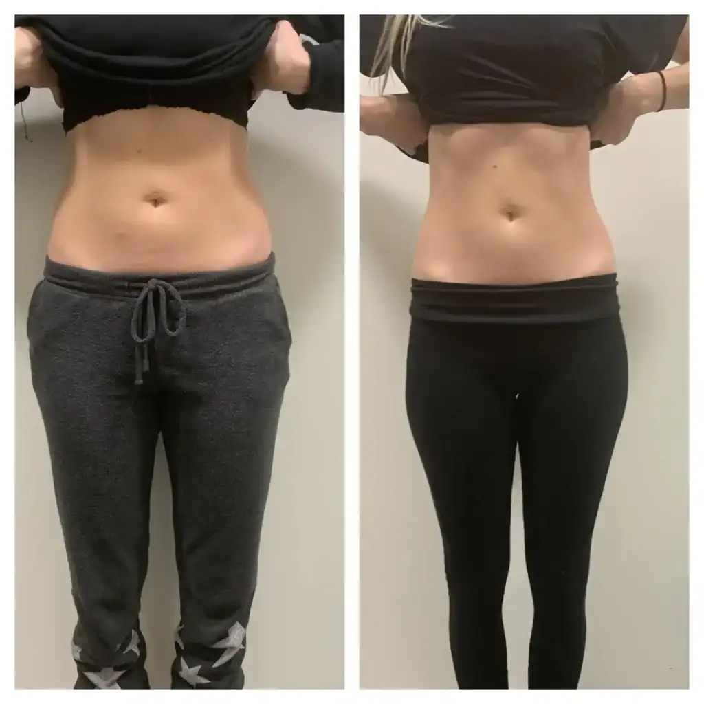 Before: 36 years · two 45-min sessions