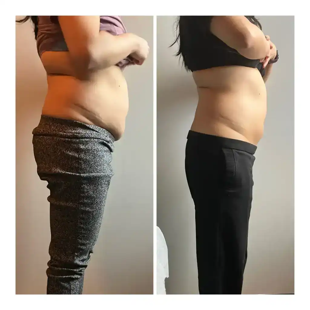 Before: 31 years · five 90-min sessions