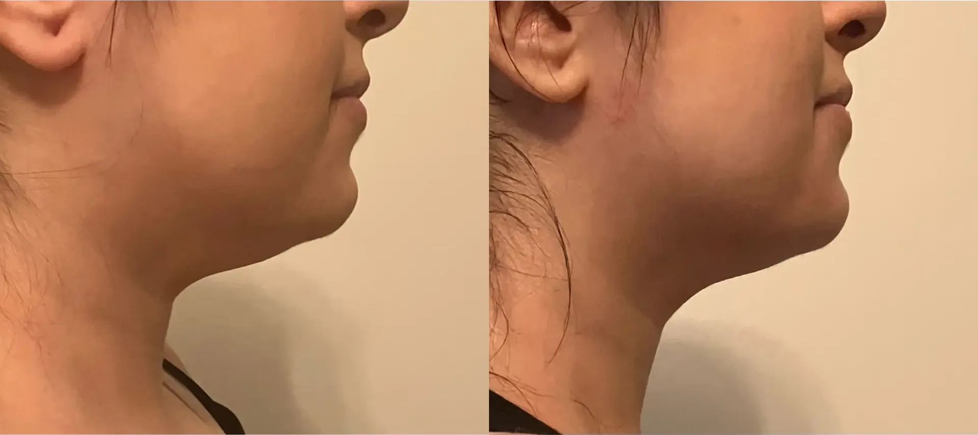 Before treatment: 31 years