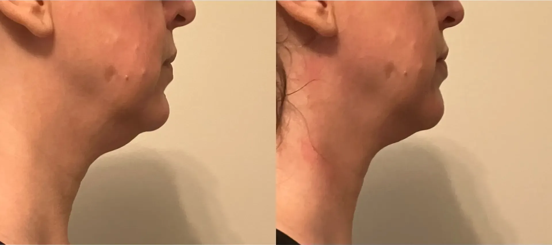 Before treatment: 31 years