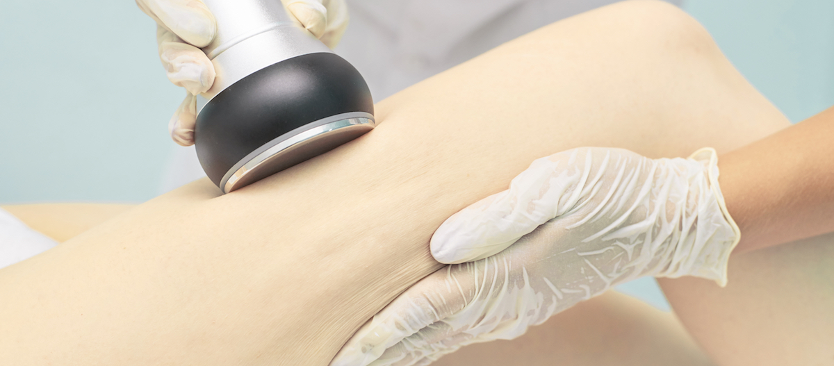 ultrasonic body cavitation Chicago TushToners<sup class=