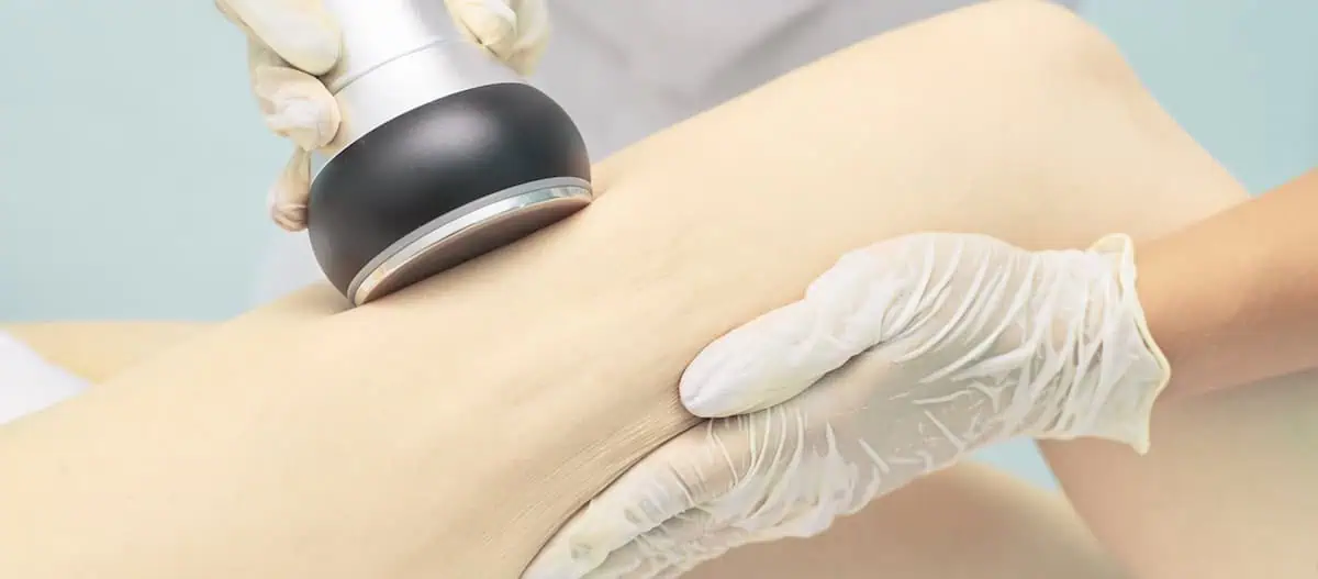 ultrasonic body cavitation Chicago TushToners<sup class=
