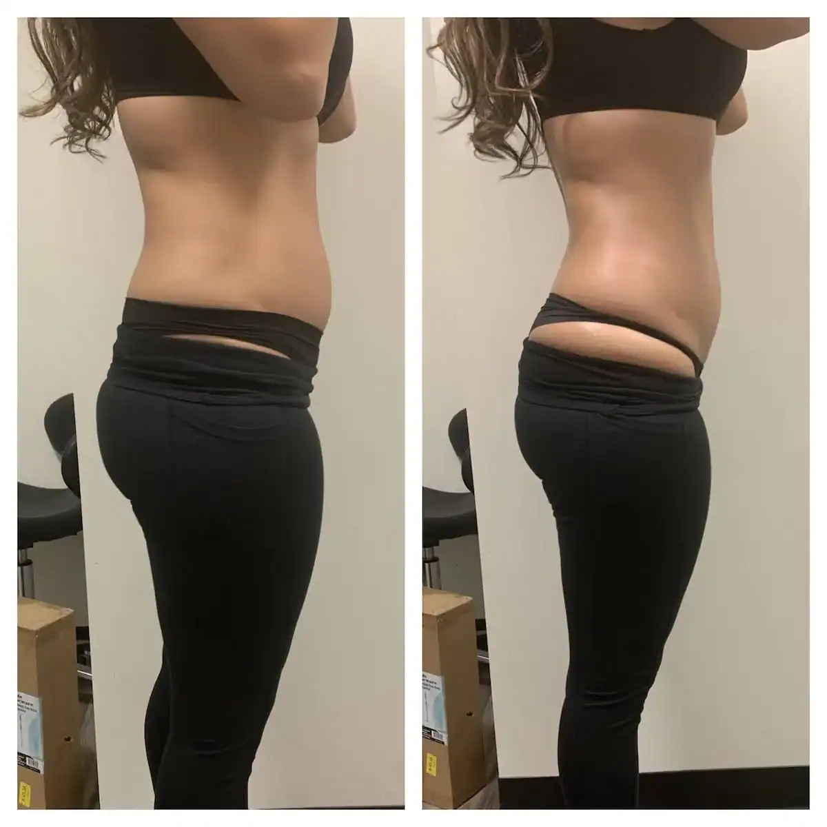 Stomach before and after: 26 years · one session, 1 inch lost