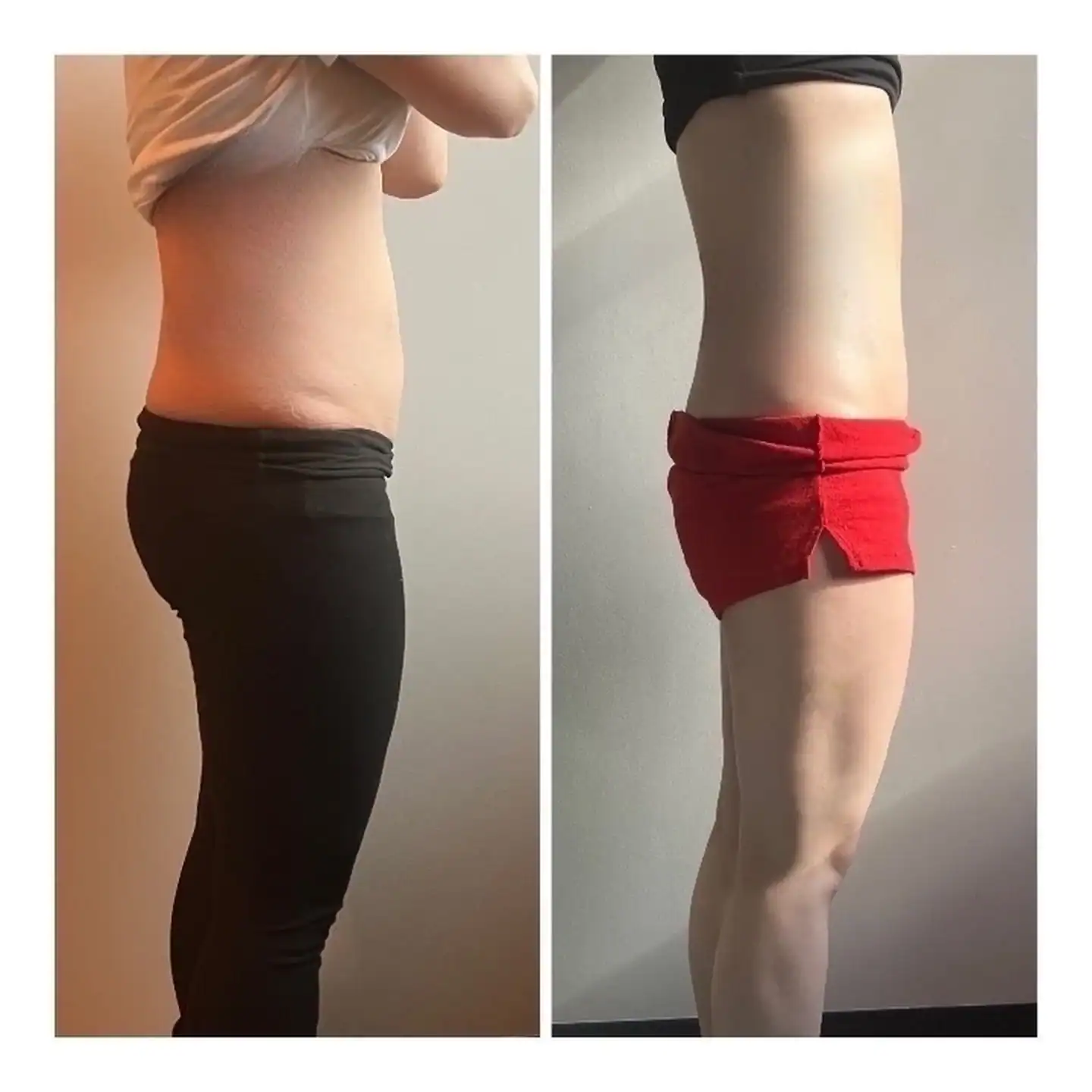 Stomach before and after: 36 years · two sessions, 2 inches lost